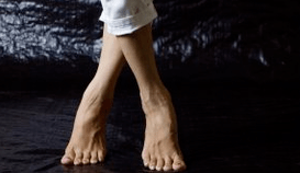 Valgusova deformacija